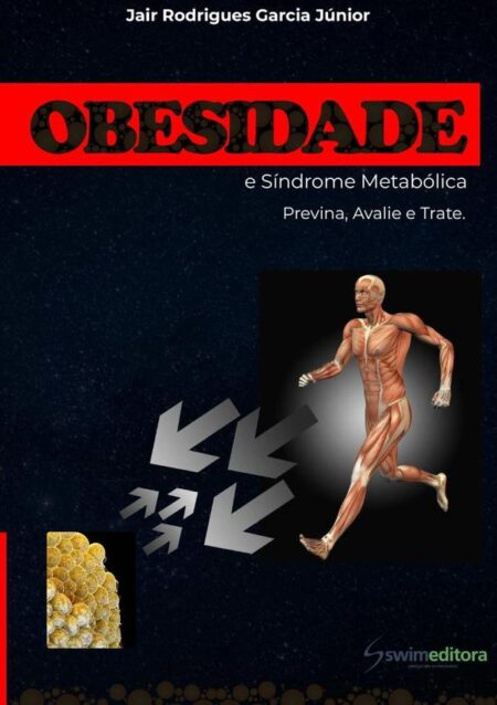 Obesidade E Síndrome Metabólica:Previna, avalie e trate