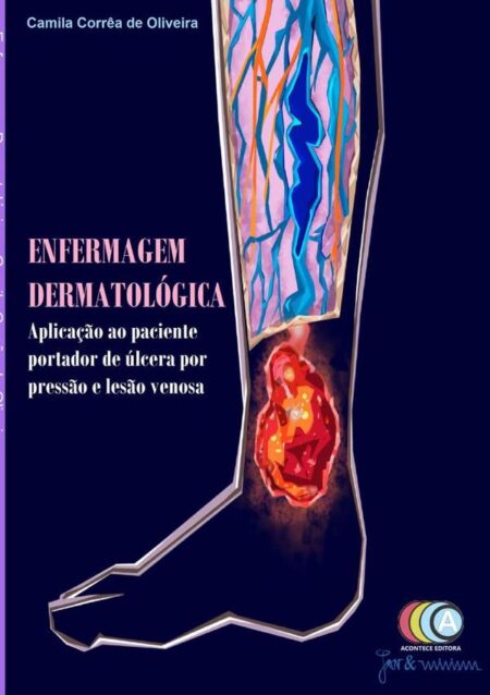 Enfermagem Dermatológica:Aplicação ao paciente portador de úlcera por pressão e lesão venosa