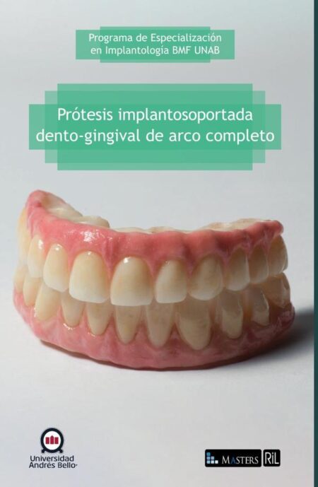 Prótesis implantosoportada dento-gingival de arco completo