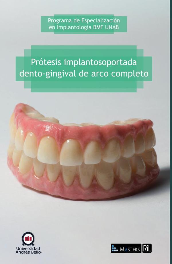 Prótesis implantosoportada dento-gingival de arco completo