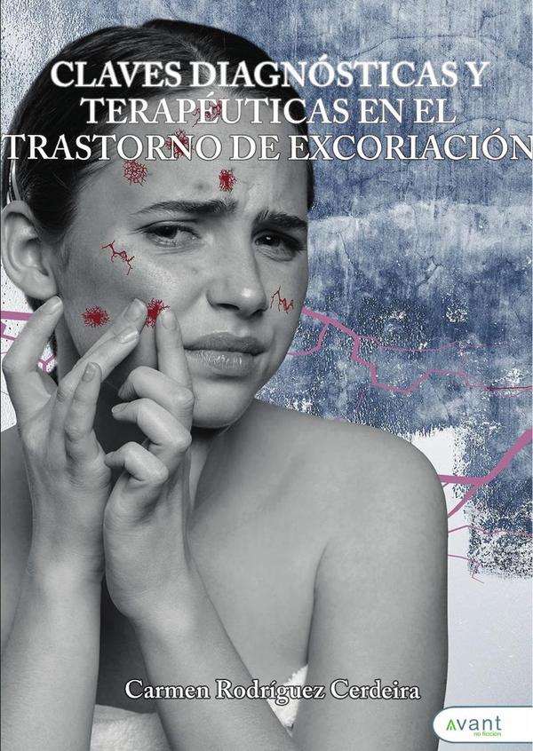 Claves diagnósticas y terapéuticas en el trastorno de excoriación