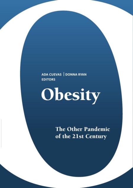 Obesity:The other pandemic of the 21st century