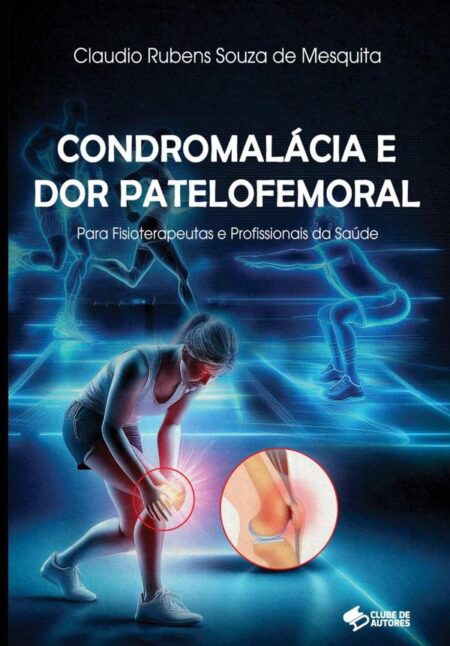 Condromalácia E Dor Patelofemoral:PARA FISIOTERAPEUTAS E PROFISSIONAIS DA SAÚDE