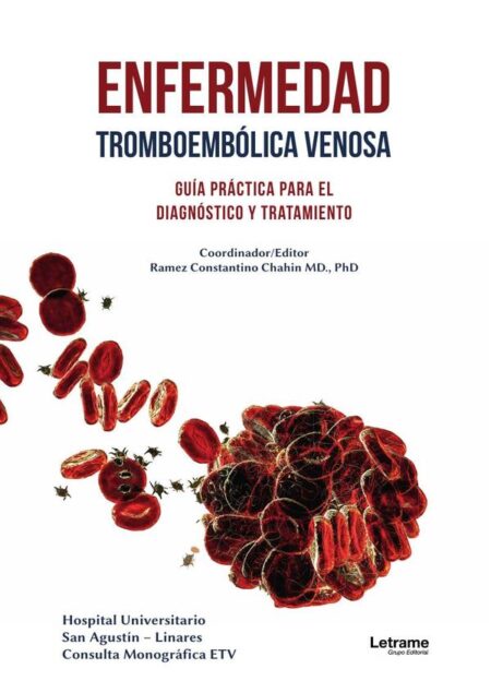 Enfermedad tromboembólica venosa:Guía práctica para el diagnóstico y tratamiento