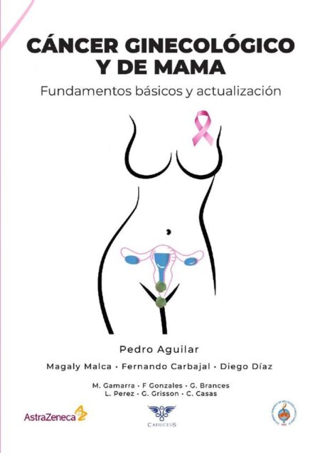 Cáncer ginecológico y de mama:Fundamentos básicos y actualización