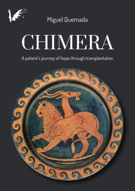 Chimera:A patient's journey of hope through transplantation