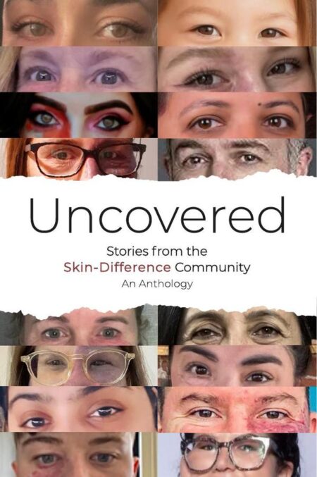 Uncovered:Stories from the Skin-Difference Community