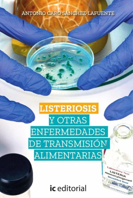 Listeriosis y otras enfermedades de transmisión alimentarias