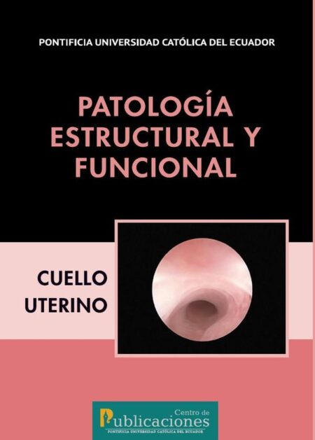 Patología estructural y funcional. Cuello uterino