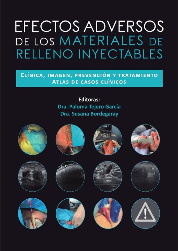 Efectos adversos de los materiales de relleno inyectables
