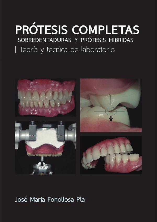 Prótesis Completas:Sobredentaduras y prótesis híbridas. Teoría y técnica de laboratorio