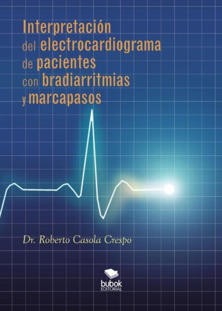 Interpretación del electrocardiograma de pacientes con bradiarritmias y marcapasos